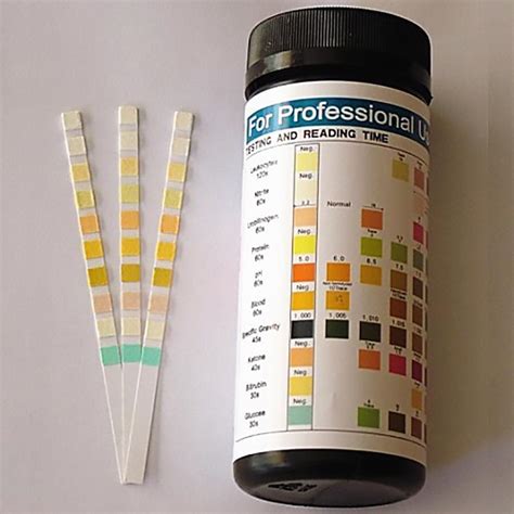 pee strip|urine test strips for urinalysis.